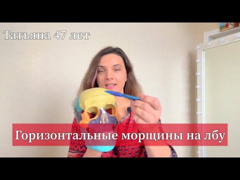 Видео: Морщины на лбу