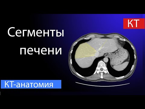 Видео: Сегменты печени на КТ