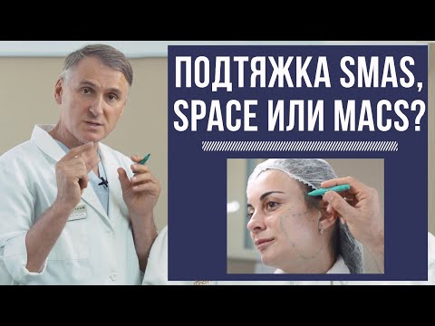 Видео: ❗️ПОДТЯЖКА ЛИЦА MACS-/ SPACE-/ SMAS-ЛИФТИНГ: ЧТО ЛУЧШЕ?