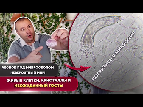 Видео: 🧄 Что скрывает чеснок под микроскопом? 😱Живые клетки, кристаллы и неожиданный гость! 🔬