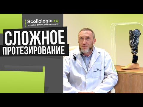 Видео: Сложное протезирование нижних конечностей