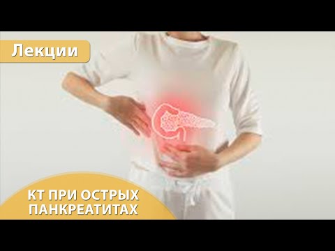 Видео: Компьютерная томография при острых панкреатитах. Андрей Мангов