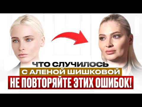 Видео: В чём ОПАСНОСТЬ КОСМЕТОЛОГИИ? Разбираем на примере Алёны Шишковой