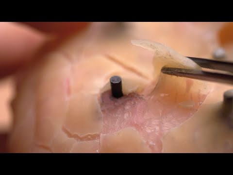 Видео: [ASMR] Сухая кожа головы и удаление волос (ролевая игра, саб)