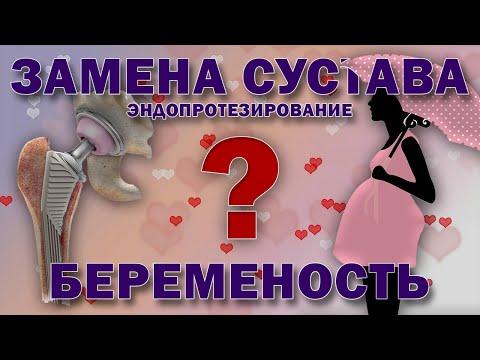 Видео: Беременность и замена сустава [S05E11]