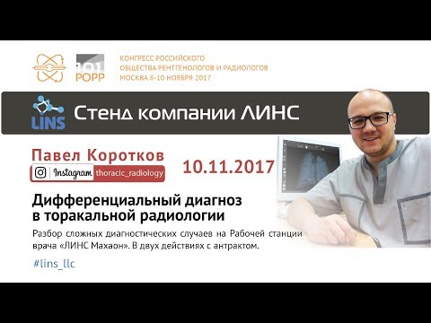 Видео: Павел Коротков. Дифференциальный диагноз в торакальной радиологии.