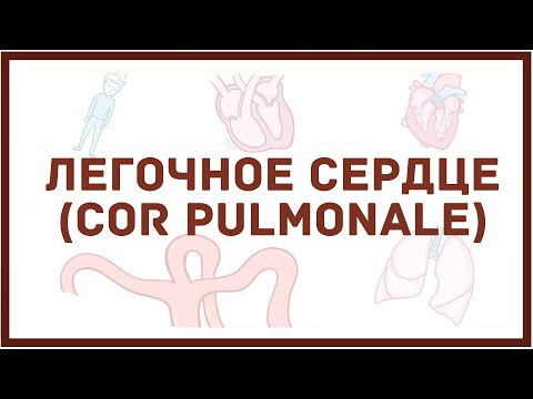 Видео: Легочное сердце - причины, симптомы, диагностика, лечение