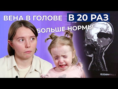 Видео: МАЛЬФОРМАЦИЯ ВЕНЫ ГАЛЕНА | История Василисы Глушенковой