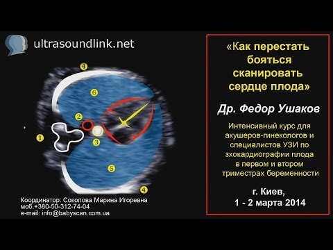 Видео: Эхокардиография плода интенсивный курс