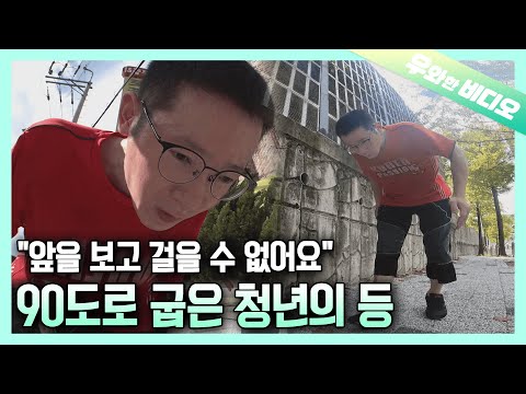 Видео: Мужчина, у которого по неизвестной причине затвердела спина под прямым углом