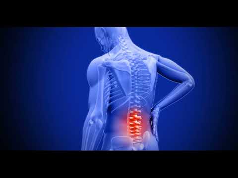 Видео: Ченнелинг Проблема со спиной, удаление причин.
