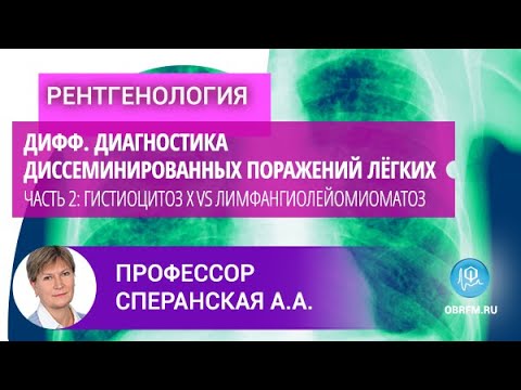 Видео: Профессор Сперанская А.А.: Дифф.диагностика диссеминированных поражений лёгких. Часть 2
