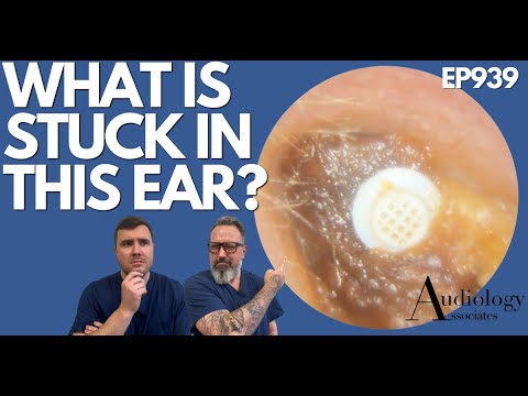 Видео: ЧТО ЗАСТРЯЛО В ЭТОМ УХЕ? - EP939