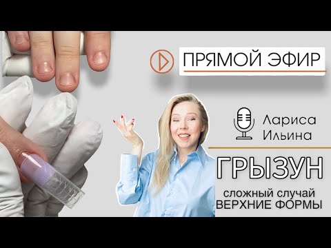 Видео: Ногти ГРЫЗУНА. Привожу в порядок в прямом эфире😁
