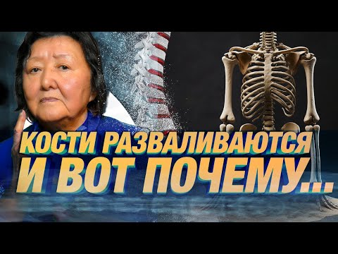 Видео: Твои КОСТИ и СУСТАВЫ разваливаются из-за этого ! #здоровье #суставы #артроз #холестерин #доктор