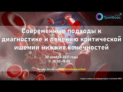 Видео: Школа Тромбоза "Современные подходы к диагностике и лечению КИНК" (20.11.2021)