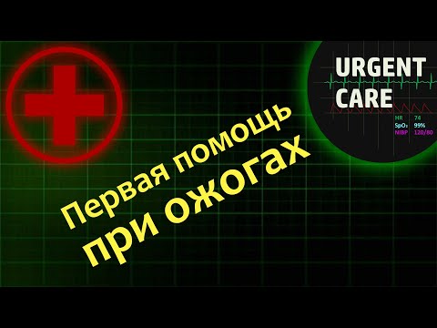 Видео: Первая помощь при ожогах у детей