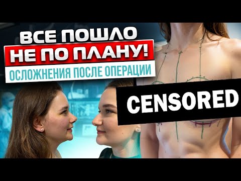 Видео: Пациентка в ШОКЕ. Жуткие осложнения после ринопластики