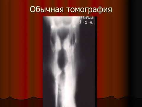 Видео: лекция №1 методы лучевой диагностики