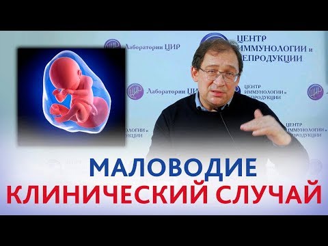 Видео: Маловодие. ПРИЧИНЫ и ПОСЛЕДСТВИЯ МАЛОВОДИЯ. Антенатальная гибель плода. Клинический случай.