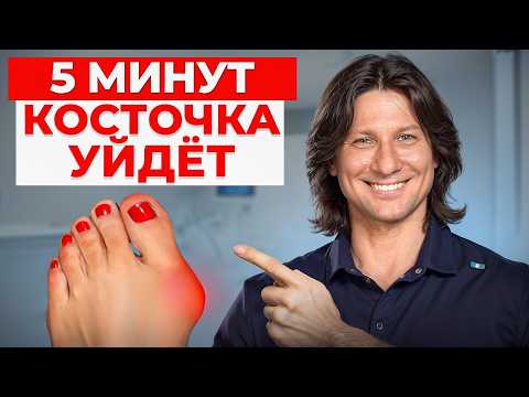 Видео: Шишка на большом пальце уйдет НАВСЕГДА! / Упражнения и рекомендации для устранения «косточки»