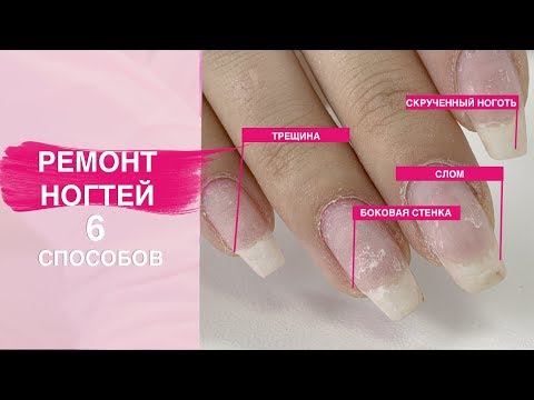 Видео: Как починить ноготь? РЕМОНТ НОГТЕЙ 6 способов