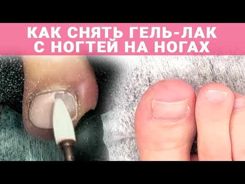 Видео: Как снять гель-лак с ногтей на ногах