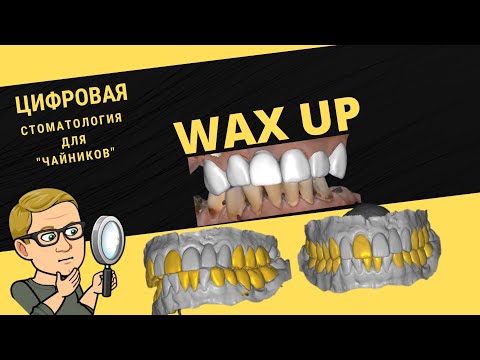 Видео: Цифровая стоматология для чайников. 4 серия. Цифровой Wax up