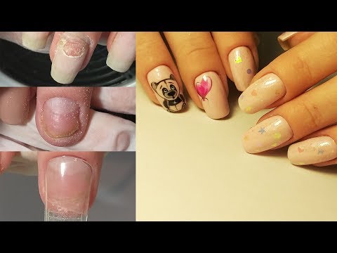 Видео: ❤ СЛАБОНЕРВНЫМ НЕ СМОТРЕТЬ ❤ история ТРАВМИРОВАННОГО ногтя ❤ Работа с клиентом ❤