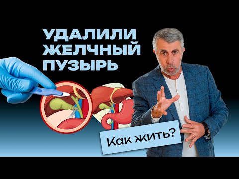 Видео: Удалили желчный пузырь. Как жить?