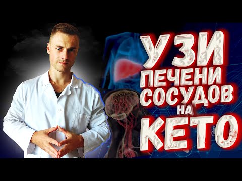 Видео: УЗИ печени и сосудов на КЕТО