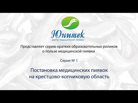 Видео: Серия 1. Постановка пиявок на крестец.