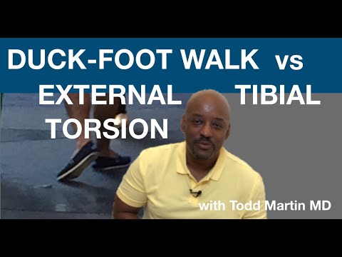 Видео: Как исправить «утиную стопу» и наружную торсию большеберцовой кости с доктором Тоддом Мартином
