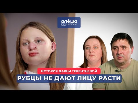 Видео: РУБЦОВЫЕ ДЕФОРМАЦИИ ТЕЛА | История Дарьи Терентьевой