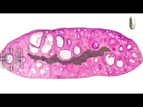 Видео: Гистологическое строение органов женской половой системы. Учебный фильм.