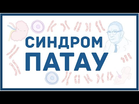 Видео: Синдром Патау - механизм развития, причины, клинические проявления