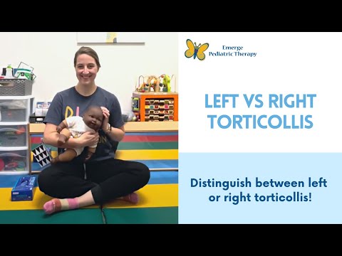 Видео: Левосторонняя или правосторонняя кривошея?