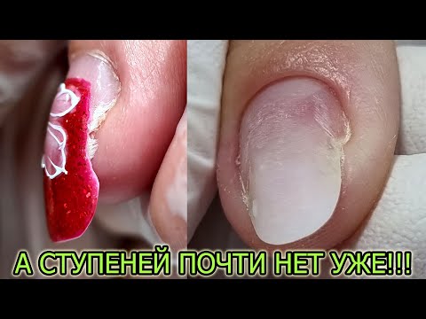 Видео: СЛОЖНАЯ коррекция ❤ ПРОБЛЕМНЫЕ точки вроста ❤ COSMOPROFI    #innamaksimova