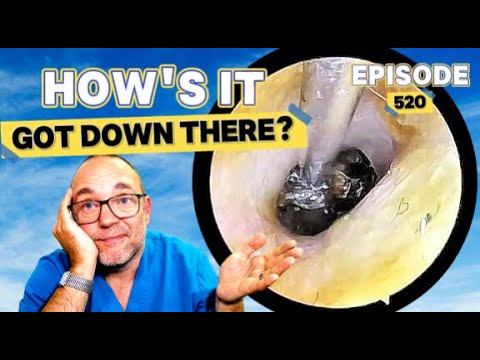 Видео: КАК ОНО ТУДА ПОПАЛО? Выпуск 520