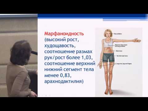 Видео: Правдюк Н. Г. Дисплазии соединительной ткани - ревматологические аспекты | Признаки симптомы лечение