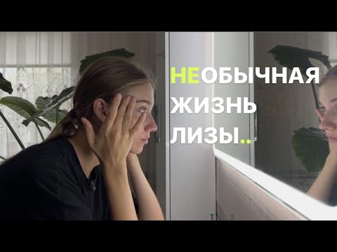 Видео: Несколько дней из моей жизни || Дерматит, кризис года, рецепты || Никита ходит 🔥