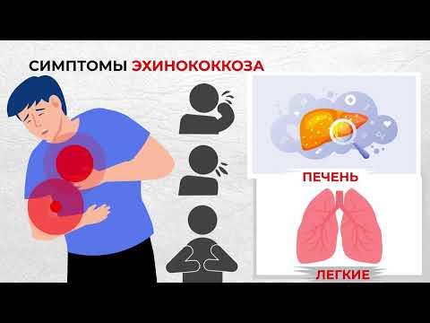 Видео: Эхинококкоз