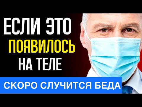 Видео: Если на теле пожилого человека вдруг появляется это, готовьтесь к худшему