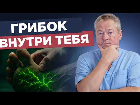 Видео: Как избавиться от грибка ногтей и кожи навсегда