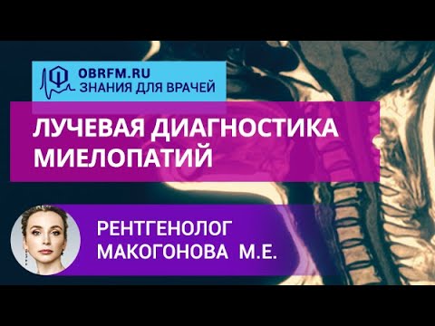 Видео: Рентгенолог Макогонова М.Е.: Лучевая диагностика миелопатий