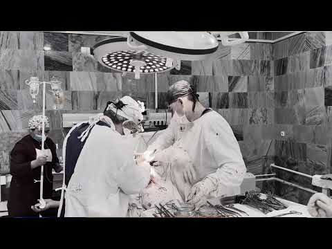 Видео: Ошкозон саратони, бир бемор ракдан кутилди!