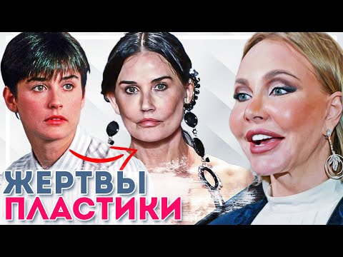 Видео: Знаменитости, которые явно переборщил с пластикой