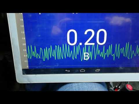 Видео: Про шаблонный подход, ГБО и лямбда зонд