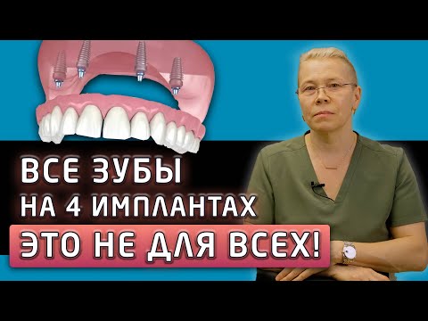Видео: ПРО ЭТО МАЛО КТО ГОВОРИТ! Почему концепция все на 4 имплантах подходит не всем пациентам?