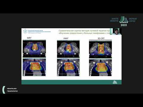 Видео: Новые технологии в лучевой терапии лимфом (Виноградова Ю.Н.)